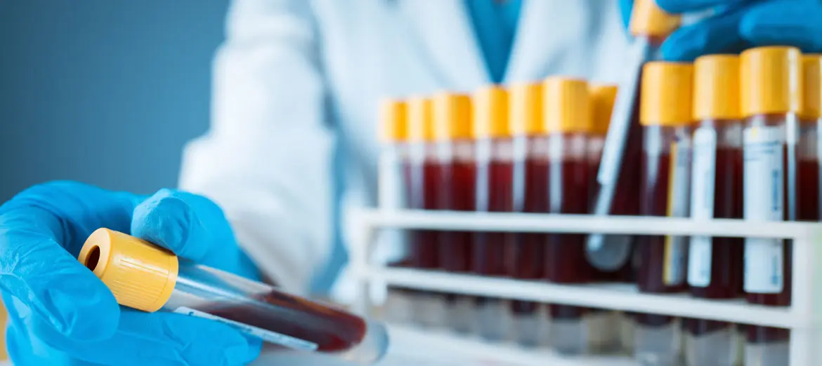 ayuno-para-analisis-de-sangre_banner