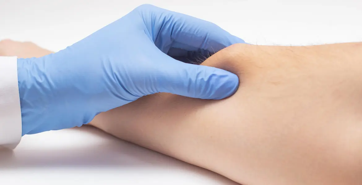 lipomas-malignos_banner