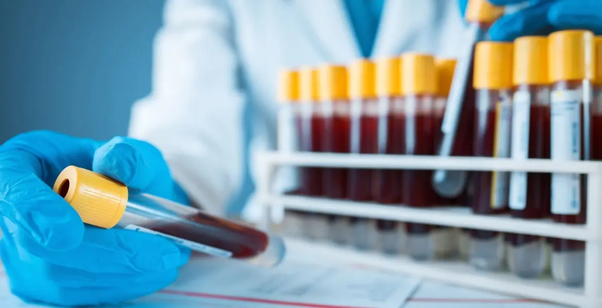 se-puede-detectar-el-cancer-con-un-analisis-de-sangre-normal_banner